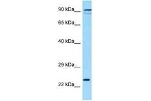 Image no. 1 for anti-Killer Cell Lectin-Like Receptor Subfamily K, Member 1 (KLRK1) (AA 121-170) antibody (ABIN6748394) (KLRK1 抗体  (AA 121-170))