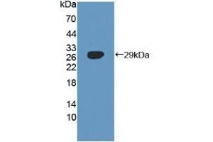 Detection of Recombinant SNX13, Human using Polyclonal Antibody to Sorting Nexin 13 (SNX13) (SNX13 抗体  (AA 97-284))