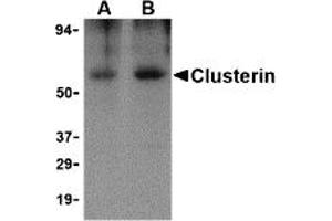 Western Blotting (WB) image for anti-Clusterin (CLU) antibody (ABIN1031714) (Clusterin 抗体)