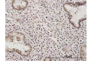 Immunohistochemistry (Formalin-fixed Paraffin-embedded Sections) (IHC (fp)) image for anti-Regulatory Solute Carrier Protein, Family 1, Member 1 (RSC1A1) (AA 1-617) antibody (ABIN519924)