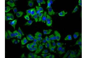 Immunofluorescence staining of MCF-7 cells with ABIN7173159 at 1:66, counter-stained with DAPI. (TMEM231 抗体  (AA 161-261))