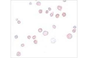 Immunocytochemistry of FREM1 in K562 cells with FREM1 antibody at 20 μg/ml. (FREM1 抗体  (C-Term))