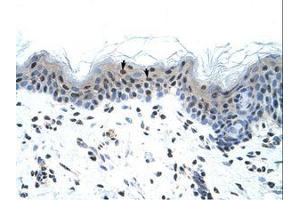 Image no. 1 for anti-Sodium Channel, Voltage-Gated, Type V, alpha Subunit (SCN5A) (AA 1856-1905) antibody (ABIN6736314) (SCN5A 抗体  (AA 1856-1905))