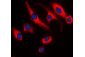 Immunofluorescent analysis of SCC-S2 staining in Raw264. (TNFAIP8 抗体  (Center))