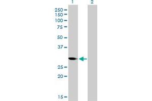 Western Blot analysis of CDC2 expression in transfected 293T cell line by CDC2 monoclonal antibody (M01), clone 1A4-1A9. (CDK1 抗体  (AA 1-297))
