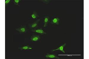 Immunofluorescence of purified MaxPab antibody to SUMO2 on HeLa cell. (SUMO2 抗体  (AA 1-95))