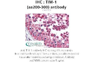 Image no. 1 for anti-Hepatitis A Virus Cellular Receptor 1 (HAVCR1) (AA 200-300) antibody (ABIN1740077) (HAVCR1 抗体  (AA 200-300))