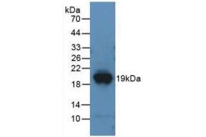 Western blot analysis of recombinant Mouse DPP4. (DPP4 抗体  (AA 29-178))