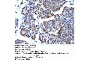Human Pancreas (CTBP1 抗体  (C-Term))