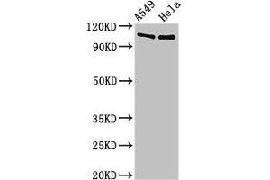Western Blot Positive WB detected in: A549 whole cell lysate, Hela whole cell lysate All lanes: EML4 antibody at 3 μg/mL Secondary Goat polyclonal to rabbit IgG at 1/50000 dilution Predicted band size: 109, 103 kDa Observed band size: 109 kDa (EML4 抗体  (AA 1-62))