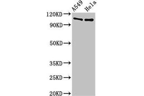 EML4 抗体  (AA 1-62)