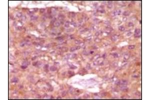 Immunohistochemistry (IHC) image for anti-Steroid Receptor RNA Activator 1 (SRA1) (truncated) antibody (ABIN2464107) (SRA1 抗体  (truncated))