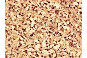 Immunohistochemistry (IHC) image for anti-Carbonic Anhydrase I (CA1) (AA 2-261) antibody (ABIN7146698)