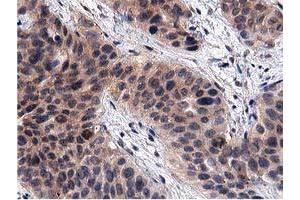 Image no. 3 for anti-Acyl-CoA Thioesterase 12 (ACOT12) antibody (ABIN1496414) (ACOT12 抗体)