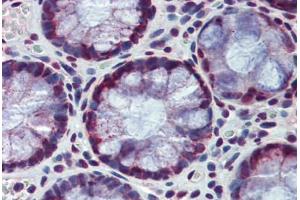 Human Colon: Formalin-Fixed, Paraffin-Embedded (FFPE) (HDAC1 抗体  (AA 271-477))