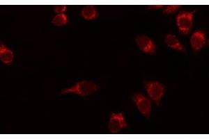 ABIN6276214 staining HuvEc by IF/ICC. (SMO 抗体  (N-Term))