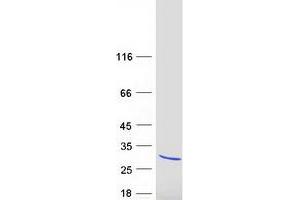 Western Blotting (WB) image for Kv Channel Interacting Protein 1 (KCNIP1) (Transcript Variant 2) protein (Myc-DYKDDDDK Tag) (ABIN2724021)