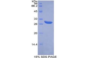 SDS-PAGE analysis of Human ABCG1 Protein. (ABCG1 蛋白)