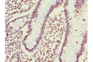 Immunohistochemistry of paraffin-embedded human small intestine tissue using ABIN7164405 at dilution of 1:100 (CIAO1 抗体  (AA 1-339))