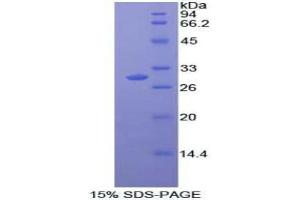 SDS-PAGE analysis of Human MAPK11 Protein. (MAPK11 蛋白)