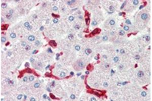 Human Liver (formalin-fixed, paraffin-embedded) stained with HMOX1 antibody ABIN462109 at 10 ug/ml followed by biotinylated goat anti-rabbit IgG secondary antibody ABIN481713, alkaline phosphatase-streptavidin and chromogen. (HMOX1 抗体)