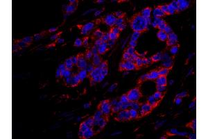 Immunofluorescence (IF) image for anti-Dedicator of Cytokinesis 4 (DOCK4) (AA 1725-1775) antibody (ABIN7448952) (DOCK4 抗体  (AA 1725-1775))