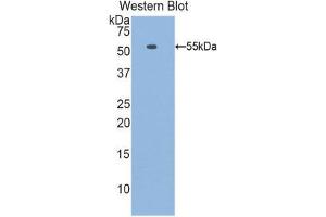 Western Blotting (WB) image for anti-Laminin, beta 1 (LAMB1) (AA 1053-1258) antibody (ABIN1859602) (Laminin beta 1 抗体  (AA 1053-1258))
