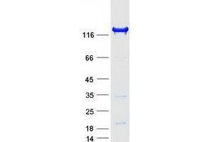 INPP5D Protein (Transcript Variant 2) (Myc-DYKDDDDK Tag)