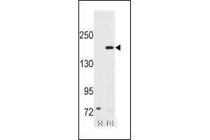 Western blot analysis of SRC1 (arrow) using rabbit polyclonal SRC1 Antibody (N-term) (ABIN391824 and ABIN2841669). (NCOA1 抗体  (N-Term))