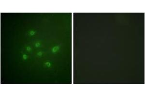 Immunofluorescence analysis of A549 cells, using DAPK3 (Phospho-Thr265) Antibody. (DAPK3 抗体  (pThr265))