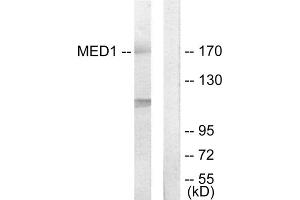 Western blot analysis of extracts from Jurkat cells, using MED1 antibody. (MED1 抗体  (Internal Region))