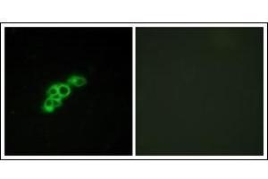 Immunofluorescence analysis of MCF7 cells, using FSHR Antibody. (FSHR 抗体  (Internal Region))