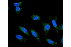 IF analysis of ADIPOR1 using anti-ADIPOR1 antibody (ABIN3043520). (Adiponectin Receptor 1 抗体  (N-Term))