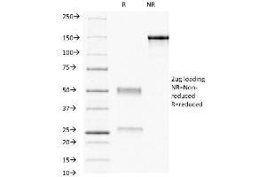 SDS-PAGE Analysis Purified Progesterone Receptor Mouse Monoclonal Antibody (PR484). (Progesterone Receptor 抗体)