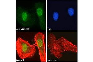 ABIN190778 Immunofluorescence analysis of paraformaldehyde fixed HeLa cells, permeabilized with 0. (GABPB2 抗体  (Internal Region))