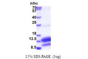 SDS-PAGE (SDS) image for phosphodiesterase 6H, CGMP-Specific, Cone, gamma (PDE6H) (AA 1-83) protein (His tag) (ABIN5853842)