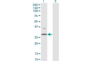 Western Blot analysis of HSD11B1 expression in transfected 293T cell line by HSD11B1 monoclonal antibody (M02A), clone 2C10. (HSD11B1 抗体  (AA 1-292))