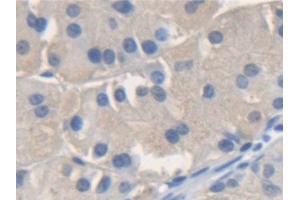 Detection of NSF in Human Stomach Tissue using Polyclonal Antibody to N-Ethylmaleimide Sensitive Factor (NSF) (NSF 抗体  (AA 590-744))