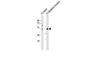 All lanes : Anti-ISLR Antibody (C-term) at 1:1000 dilution Lane 1: human heart lysate Lane 2: human skeletal muscle lysate Lysates/proteins at 20 μg per lane. (ISLR 抗体  (C-Term))