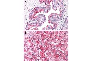 Immunohistochemical staining of formalin-fixed, paraffin-embedded human prostate (A) and human liver (B) tissue after heat-induced antigen retrieval. (ERAP1 抗体  (Internal Region))
