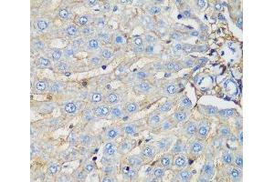 Immunohistochemistry of paraffin-embedded Rat liver using PROCR Polyclonal Antibody at dilution of 1:200 (40x lens). (PROCR 抗体)