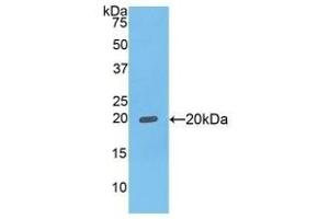Detection of Recombinant FcgBP, Human using Polyclonal Antibody to Fc Fragment Of IgG Binding Protein (FcgBP)