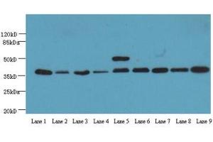 Western Blotting (WB) image for anti-Glyceraldehyde-3-Phosphate Dehydrogenase (GAPDH) (AA 3-105) antibody (ABIN2931072) (GAPDH 抗体  (AA 3-105))