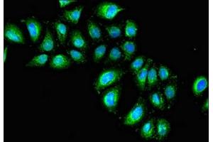 Immunofluorescent analysis of A549 cells using ABIN7156745 at dilution of 1: 100 and Alexa Fluor 488-congugated AffiniPure Goat Anti-Rabbit IgG(H+L) (IL1R1 抗体  (AA 18-320))