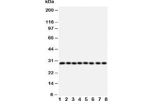 Western blot testing of CISH antibody and Lane 1:  rat liver;  2: rat kidney; and human samples  3: placenta;  4: A431;  5: SMMC-7721;  6: HeLa;  7: COLO320;  8: MM231 cell lysate (CISH 抗体  (AA 241-258))
