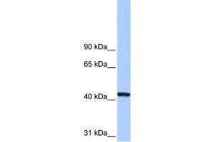 WB Suggested Anti-PGK1 Antibody Titration: 0. (PGK1 抗体  (N-Term))