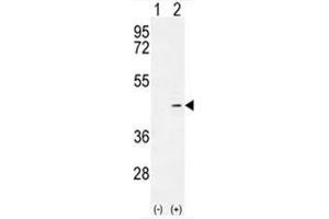Western blot analysis of ADH4 (arrow) using rabbit polyclonal ADH4 Antibody (C-term) . (ADH4 抗体  (C-Term))