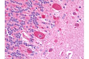 Anti-TNFRSF11A / RANK antibody IHC staining of human brain, cerebellum.