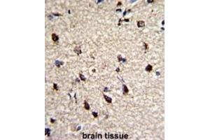 Immunohistochemistry (IHC) image for anti-Dermatopontin (DPT) antibody (ABIN3003244) (Dermatopontin 抗体)