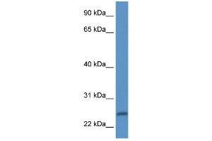 Western Blot showing PI15 antibody used at a concentration of 1 ug/ml against Fetal Heart Lysate (PI15 抗体  (N-Term))